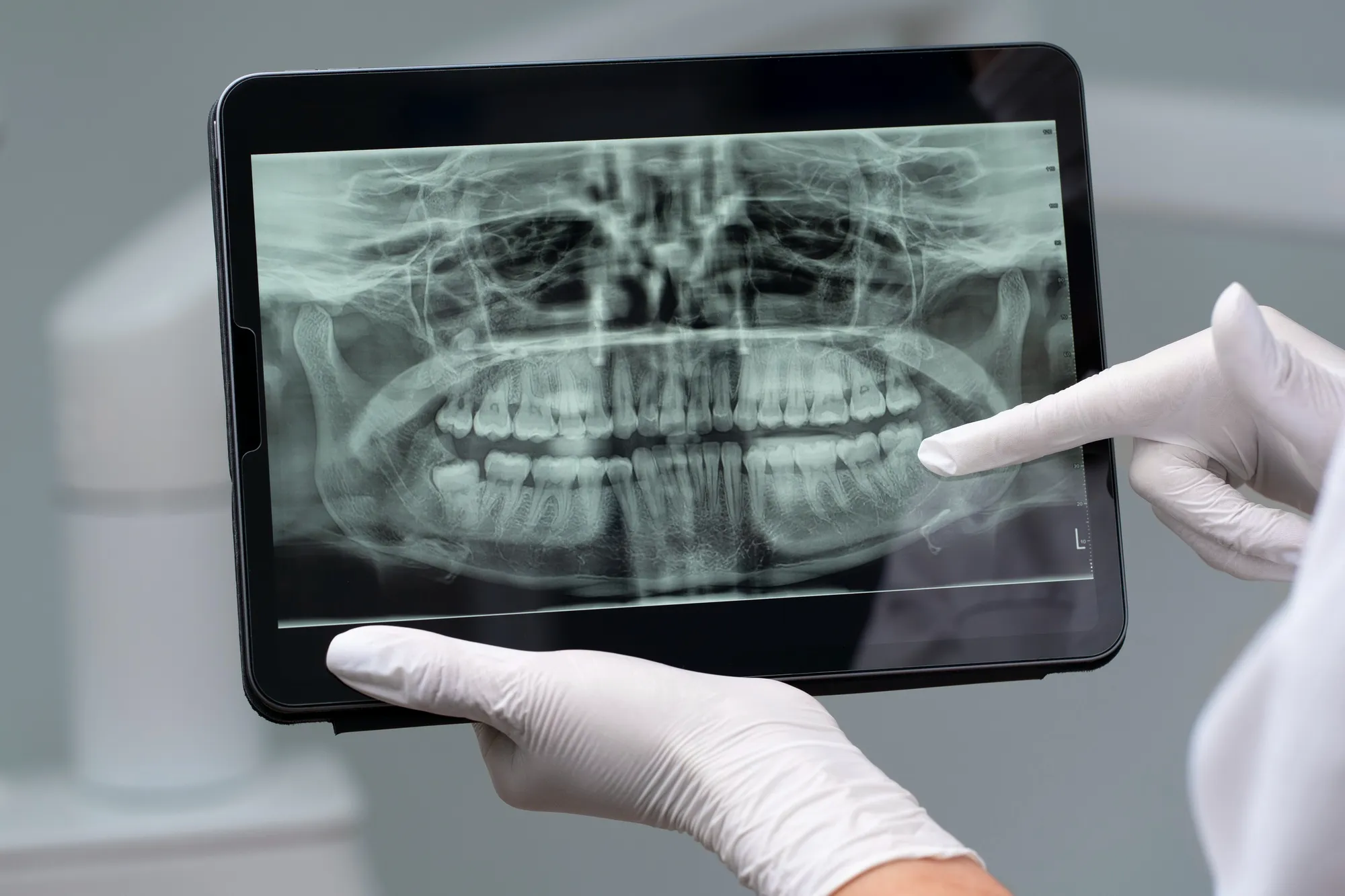 DENTAL RADIOLOGY