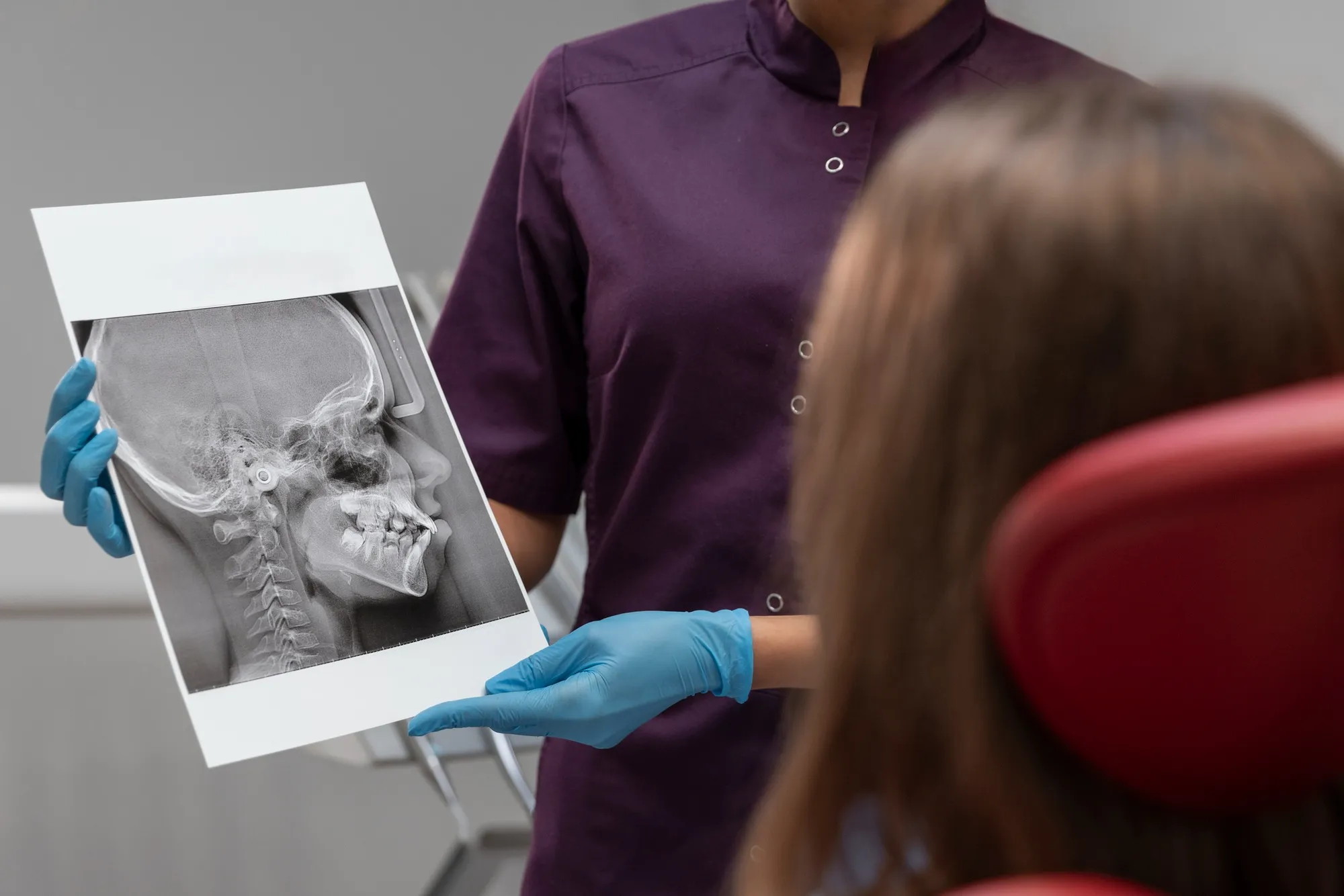 Dentalna radiologija 9