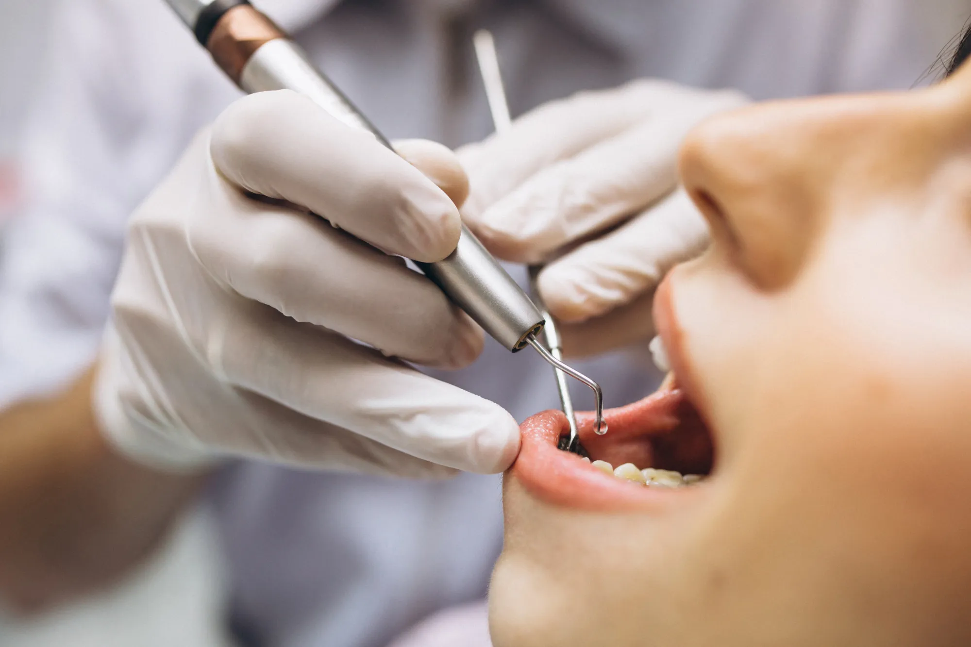 Endodoncija